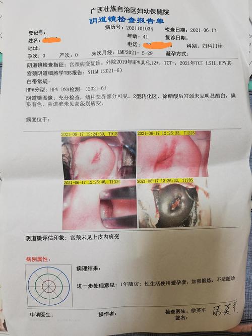 HPV转阴后千万不要做6件事太原纺织美容hpv治疗